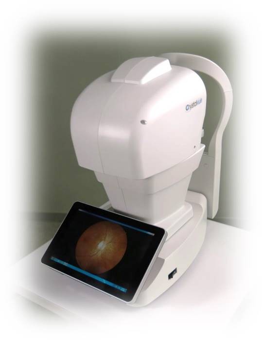 Non-Mydriatic Auto Fundus Camera