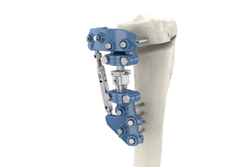 PK High Tibial Osteotomy Correction System / Paonan Biotech