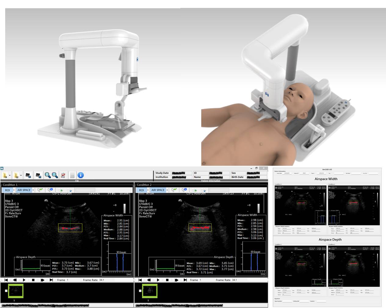 AmCAD-UO / AmCad BioMed Corporation