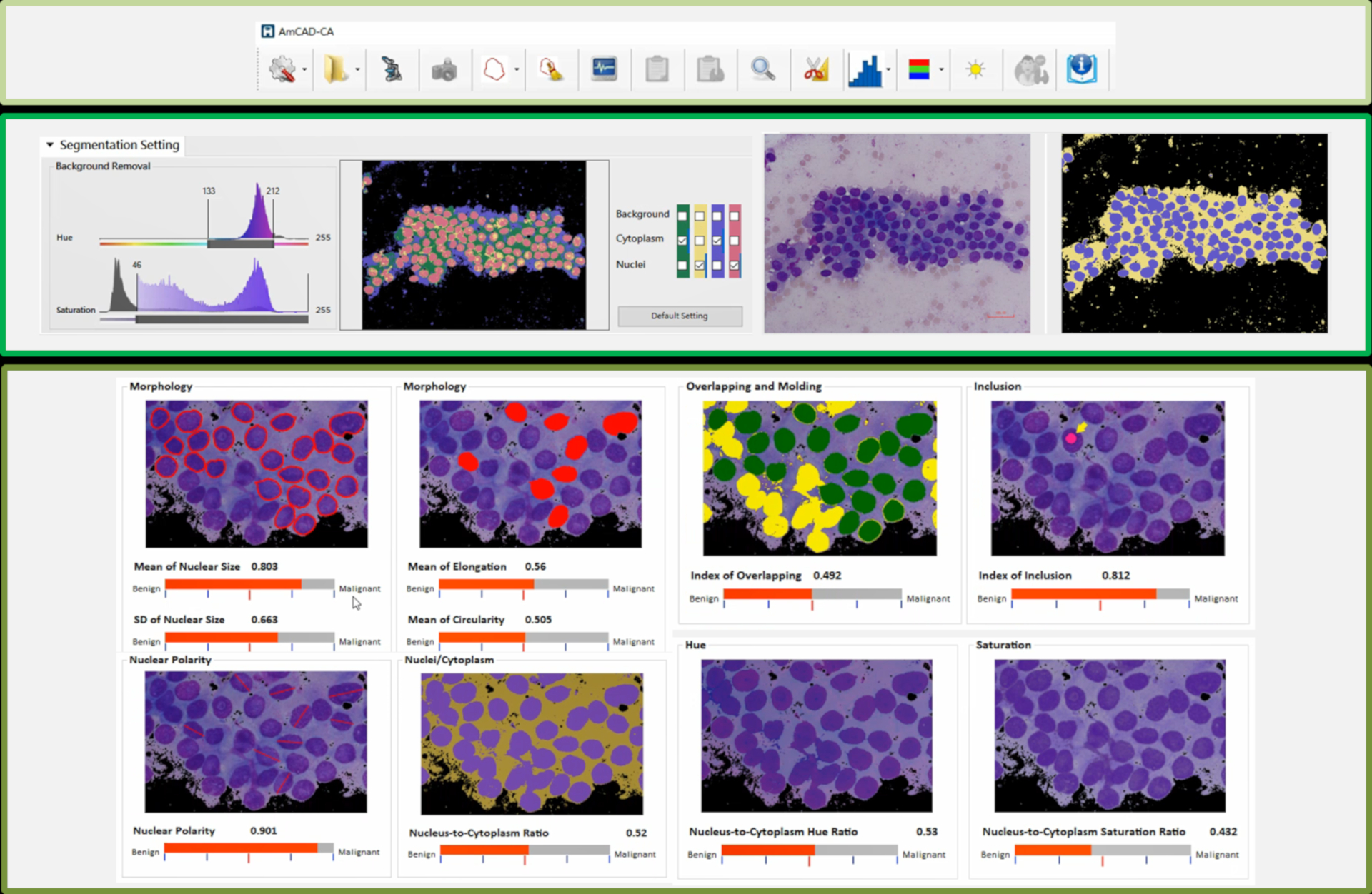 AmCAD-CA / AmCad BioMed Corporation