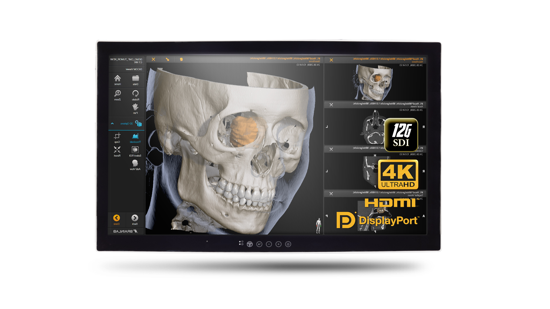 32-inch 4K UHD Surgical Work Station