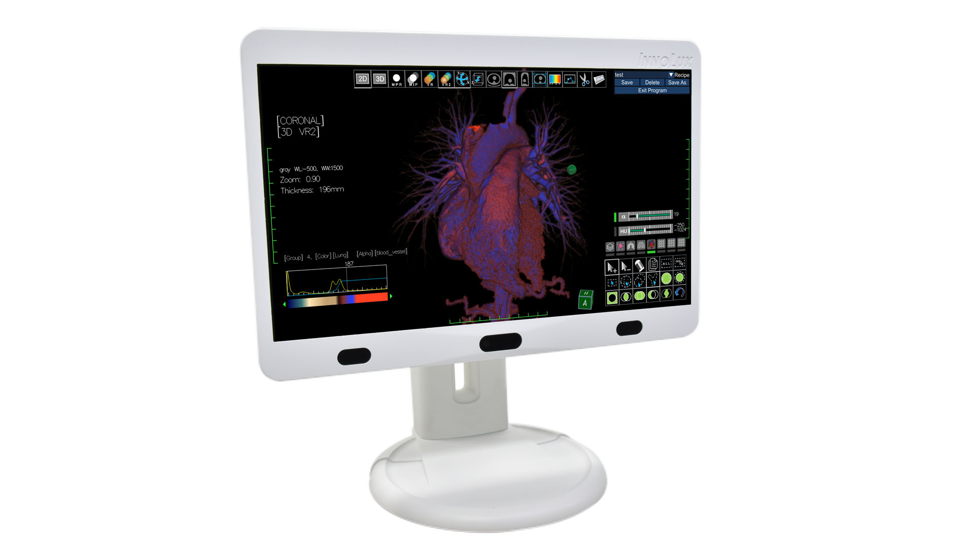 Medical Volume N3D Display