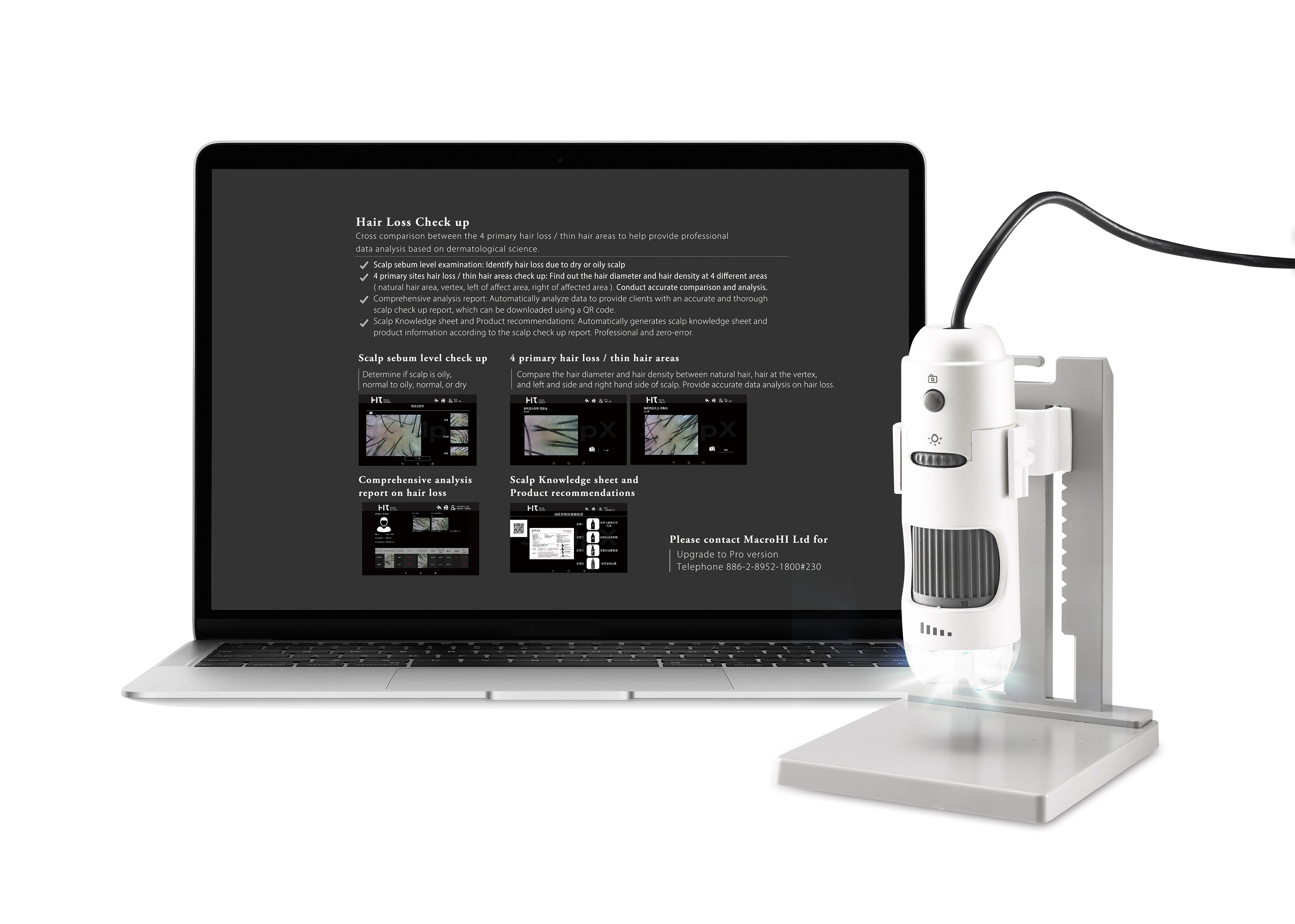 ScalpX Intelligent Scalp Diagnosis System