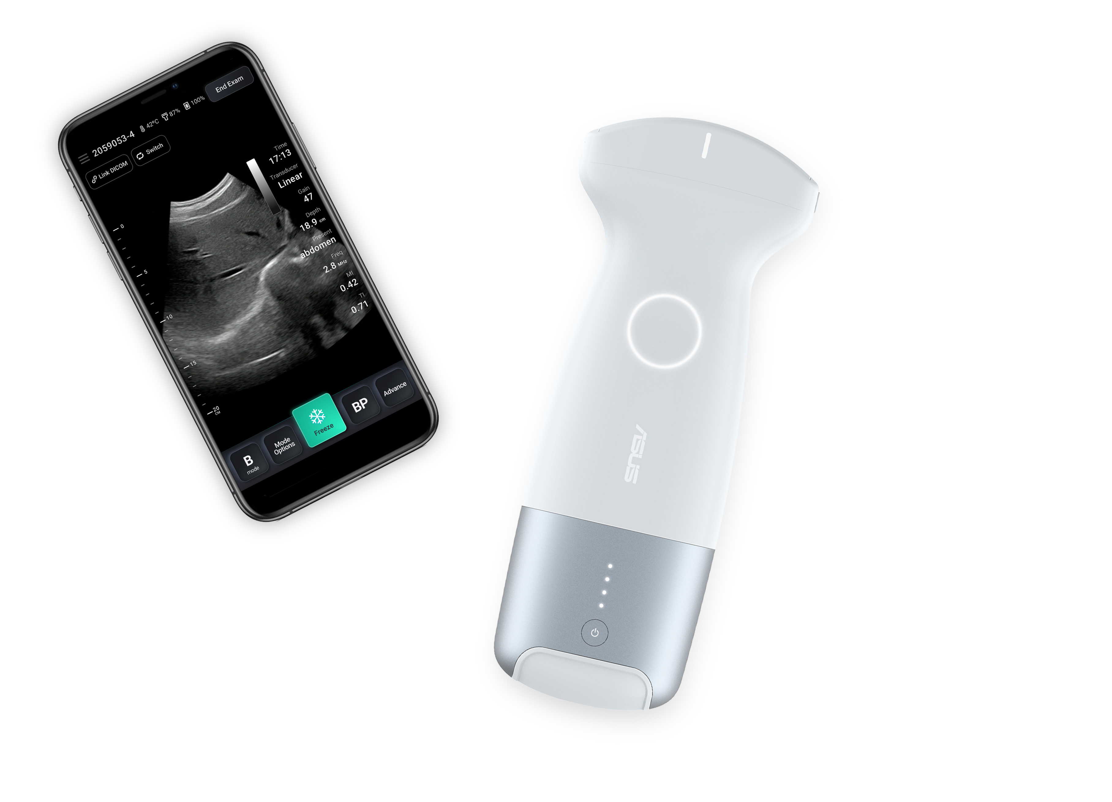 Wireless Handheld Ultrasound