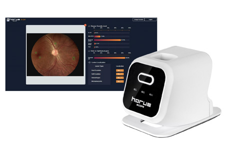 AI-assisted Diagnostic Device for Diabetic Retinopathy / Medimaging Integrated Solution Inc.