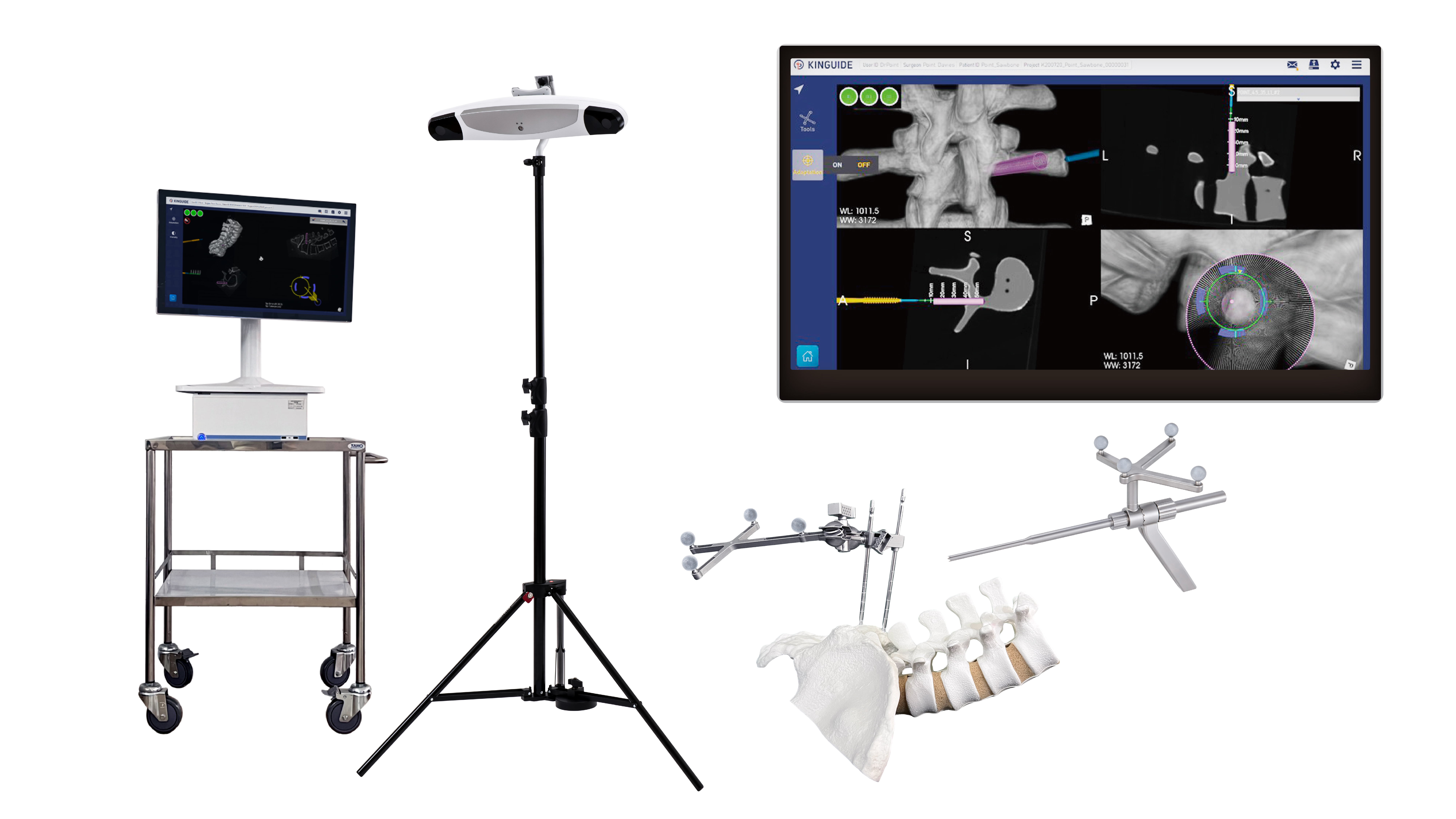 Kinguide複合型手術ナビゲーションシステム