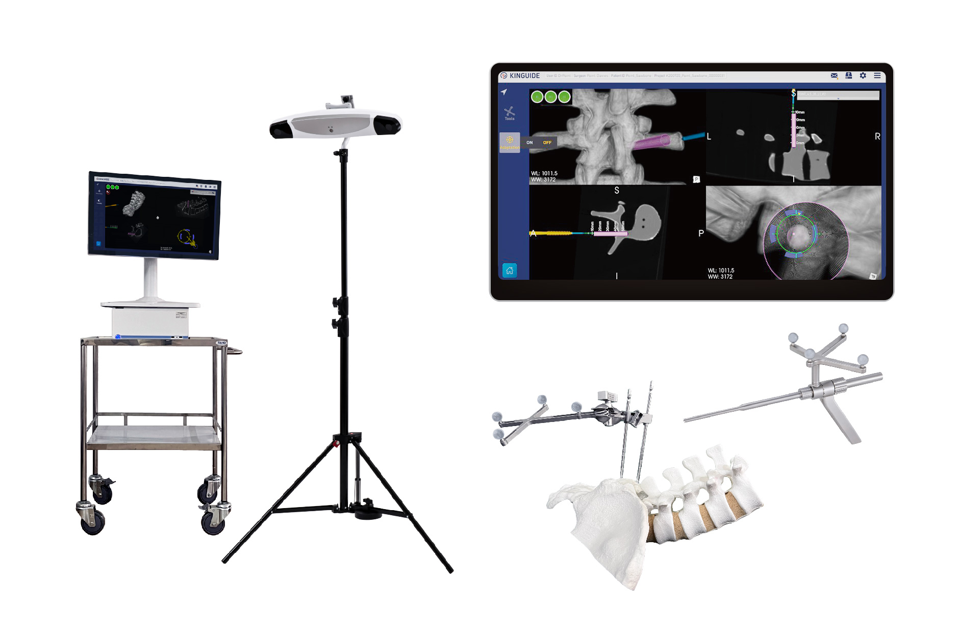 Kinguide Agile Hybrid Navigation System-POINT ROBOTICS MEDTECH INC.