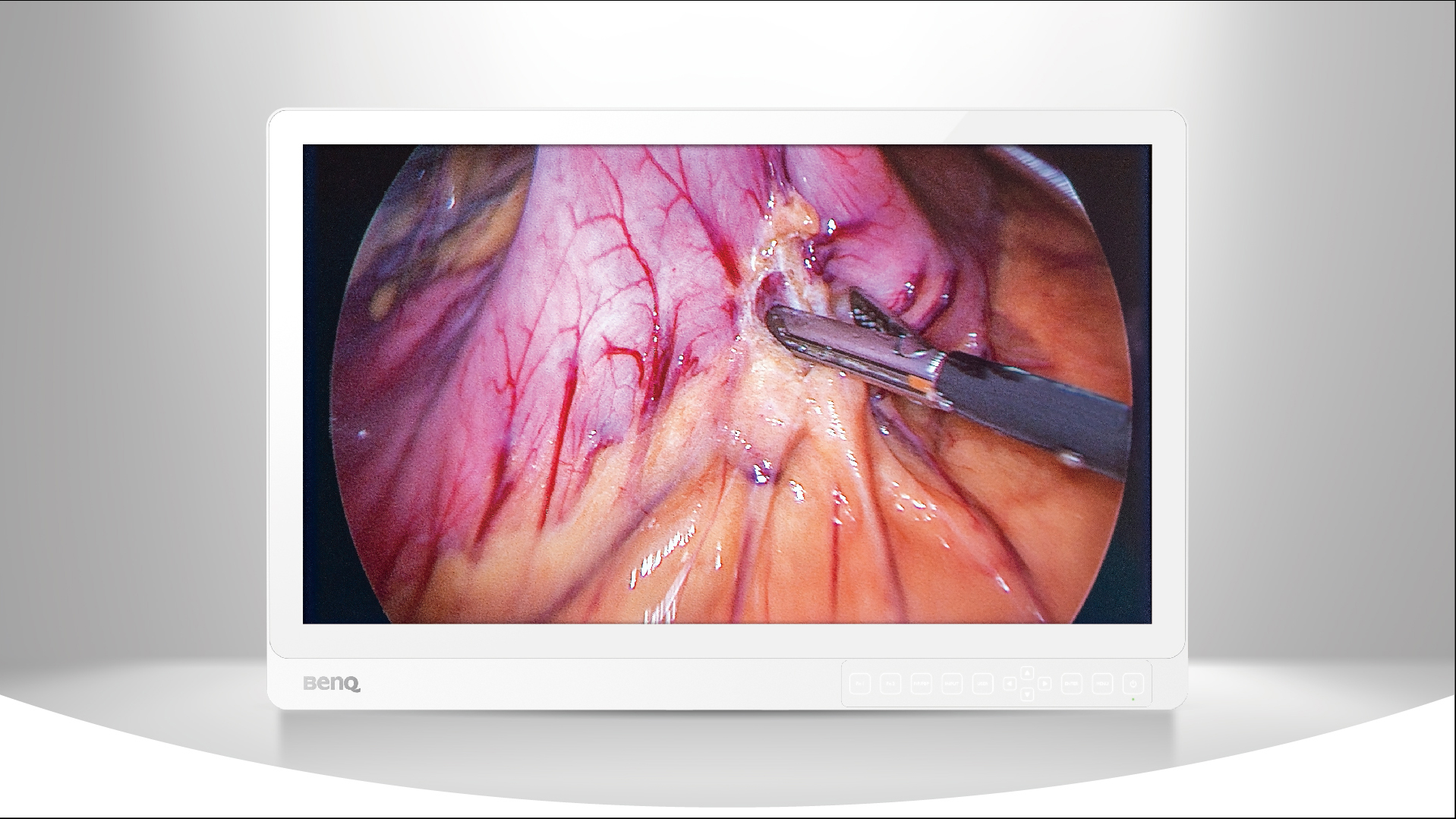 27-inch 4K medical display for endoscopes and operating rooms