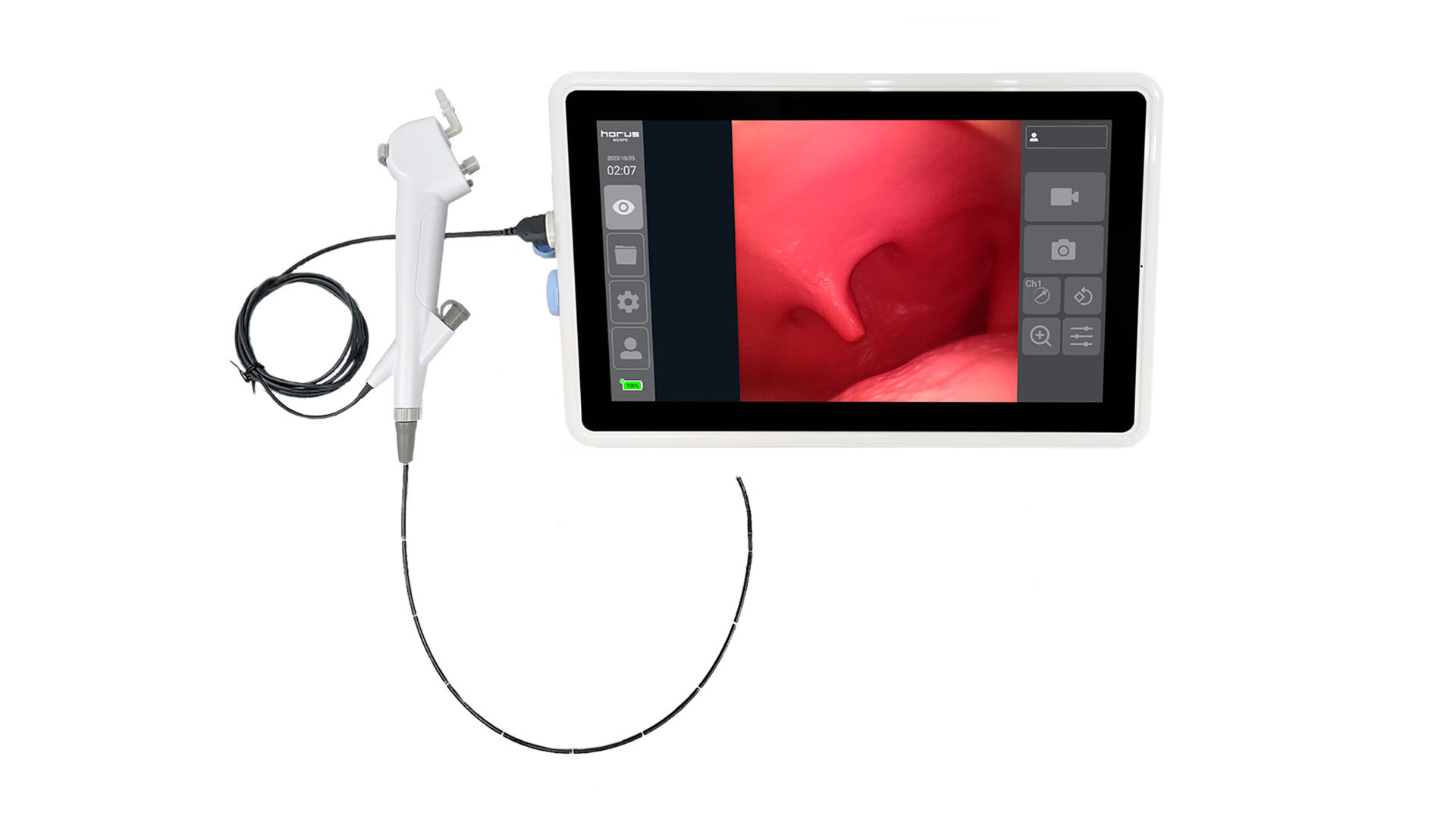 拋棄式支氣管內視鏡